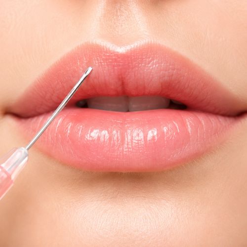 Lip Fillers